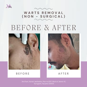 Slider image (7) Konarc Aesthetics - Plastic & Cosmetic Surgery In Gurgaon, India.
